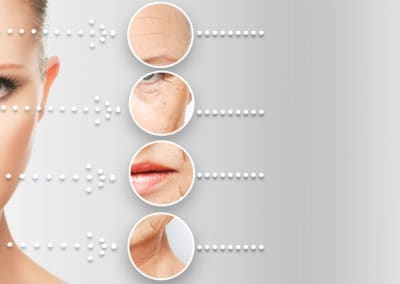 Radiofrequency