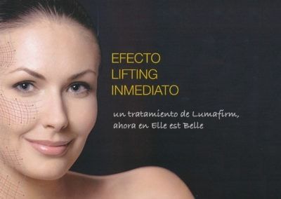 Lumafirm: immediate lifting effect