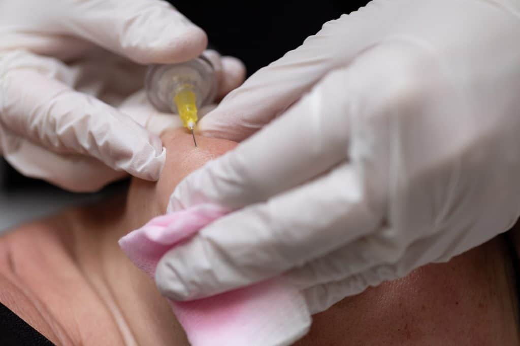 Evolución en celulitis fibrosa y estrías
