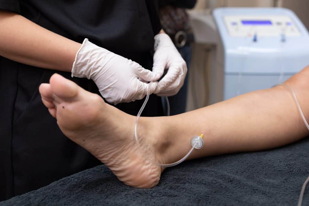 Evolución en celulitis fibrosa y estrías