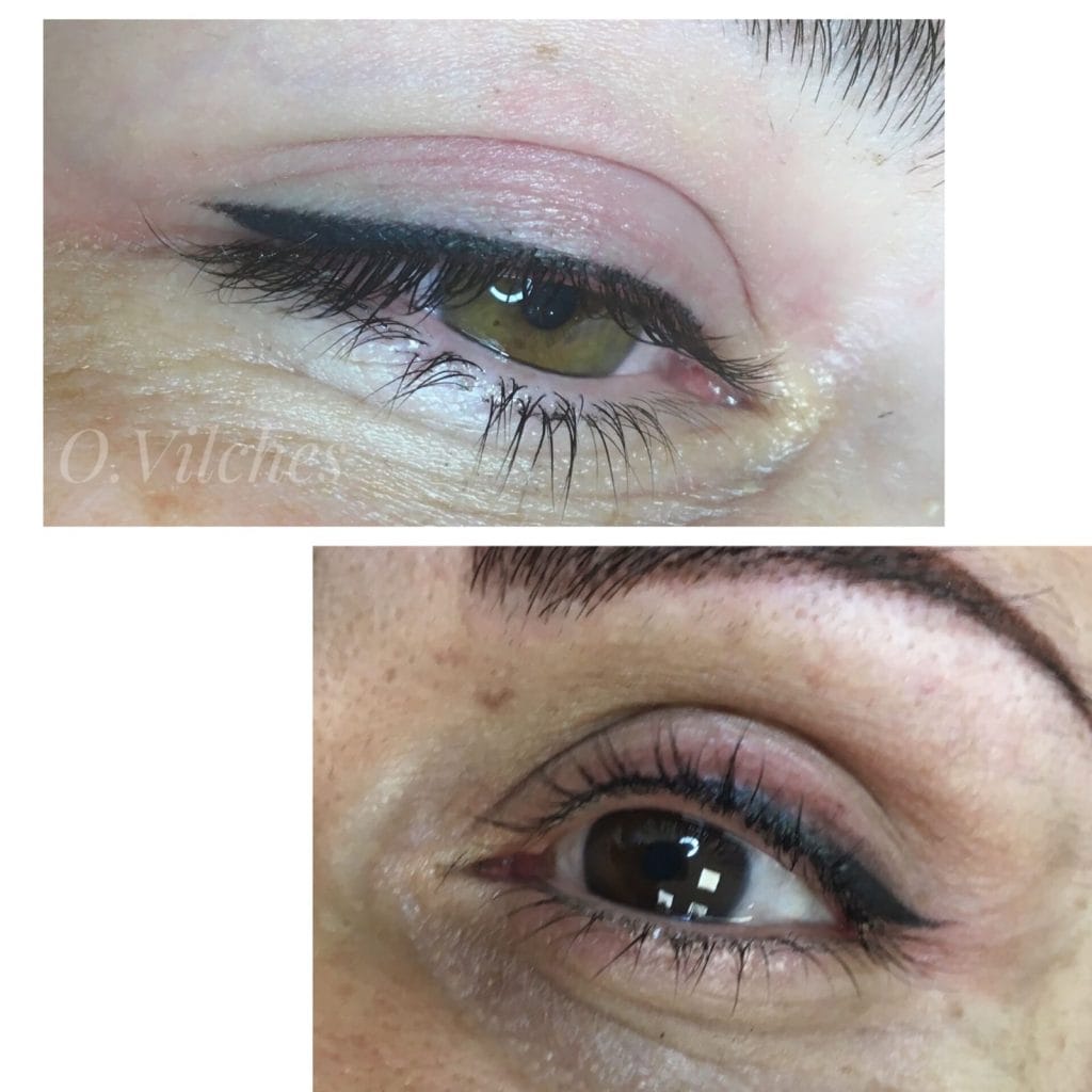 Galería de casos reales antes y después: Cejas pelo a pelo, lip blush natural, lash liner entrepestañas y reconstrucción areolar 3D