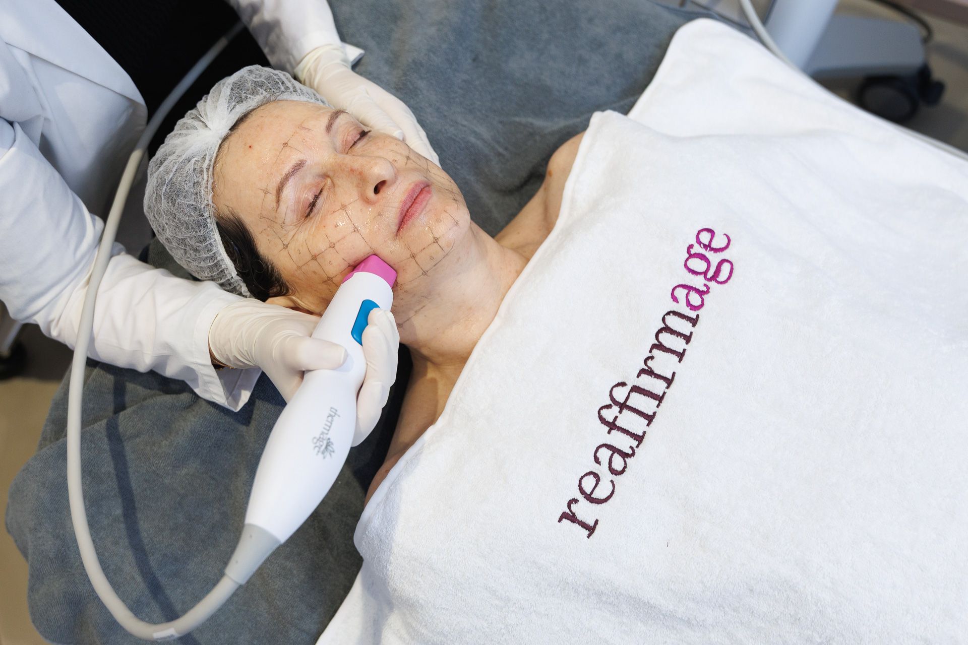 Thermage FLX