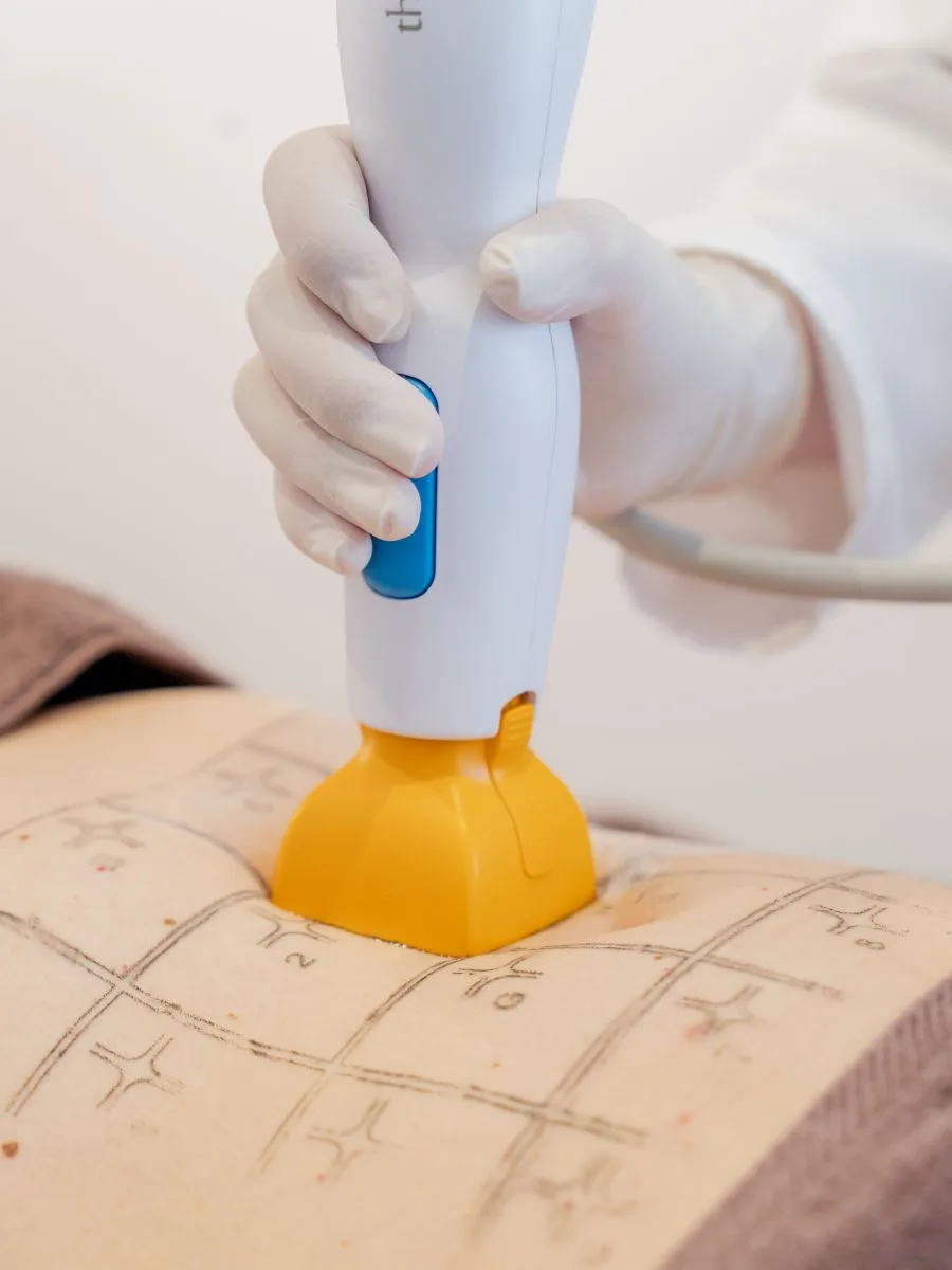 Thermage® FLX